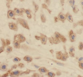 TXNDC12 Rabbit Polyclonal Antibody