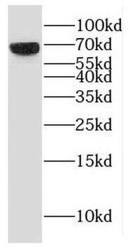 ESCO2 Antibody