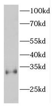 ESPN Antibody