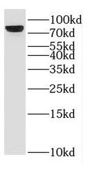ESRP2 Antibody