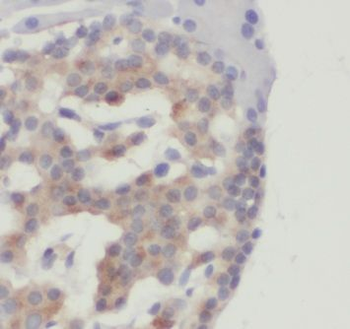 ETF1 Rabbit Polyclonal Antibody