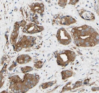 ETFDH Antibody