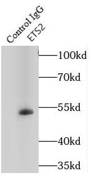 ETS2 Rabbit Polyclonal Antibody