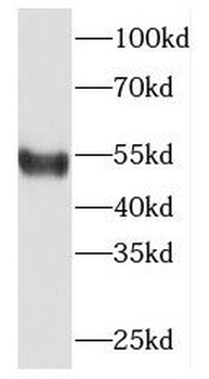 ETS2 Rabbit Polyclonal Antibody