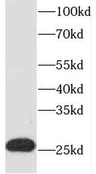 EVI2A Antibody
