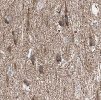 EVI2A Rabbit Polyclonal Antibody