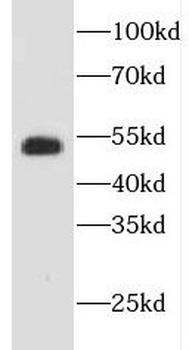 EVL Antibody