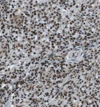 EXOSC10 Antibody
