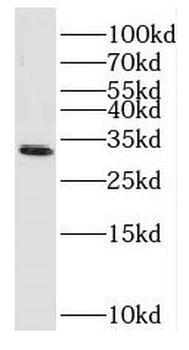 EXOSC2 Antibody