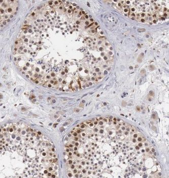 EXOSC8 Rabbit Polyclonal Antibody