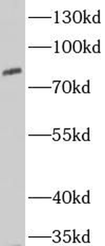 EXT2 Rabbit Polyclonal Antibody