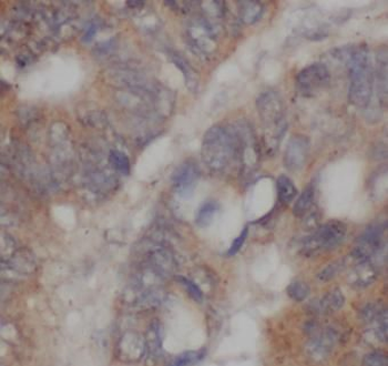 EXT2 Rabbit Polyclonal Antibody