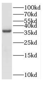 EXTL2 Antibody
