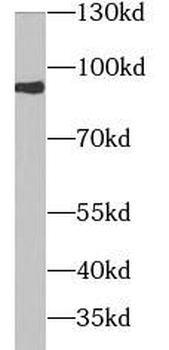 EZR Rabbit Polyclonal Antibody