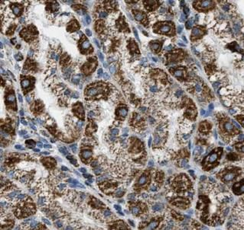 EZR Rabbit Polyclonal Antibody