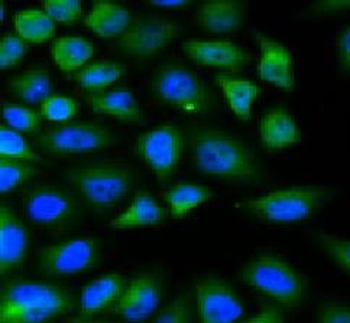 FABP4 Antibody