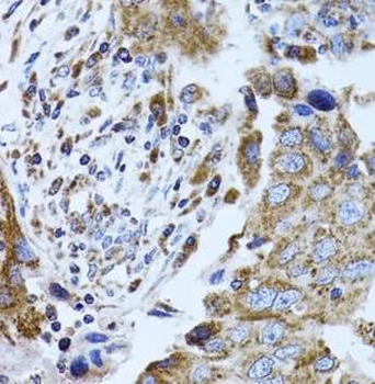 FABP4 Rabbit Polyclonal Antibody