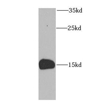 FABP5 Antibody