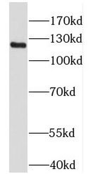 PTK2 Rabbit Polyclonal Antibody