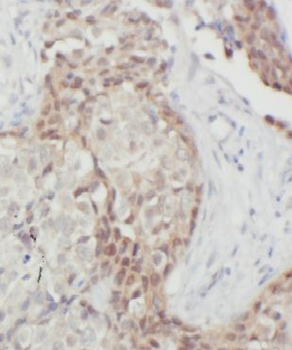 PTK2 Rabbit Polyclonal Antibody