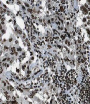FAM107A Antibody