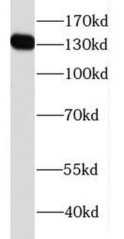 FAM111B Rabbit Polyclonal Antibody