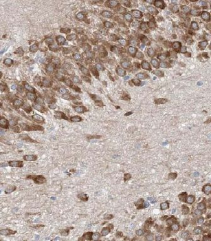 FAM114A1 Rabbit Polyclonal Antibody