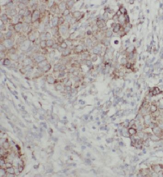 FAM117B Rabbit Polyclonal Antibody