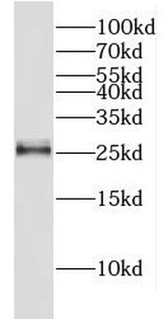 METTL21A Antibody