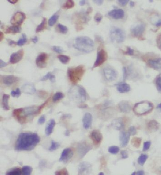 FAM124B Rabbit Polyclonal Antibody