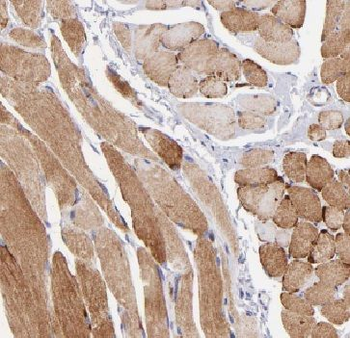 FAM13A Rabbit Polyclonal Antibody