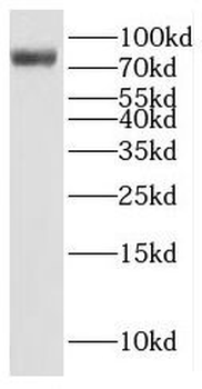 FHIP2B Antibody