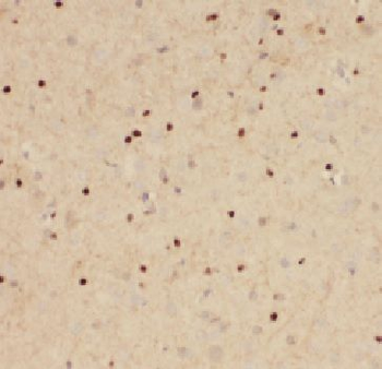 FHIP2B Rabbit Polyclonal Antibody