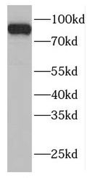 SUPT20H Rabbit Polyclonal Antibody