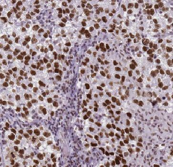 SUPT20H Rabbit Polyclonal Antibody