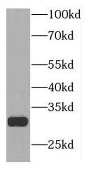 TLCD3B Antibody