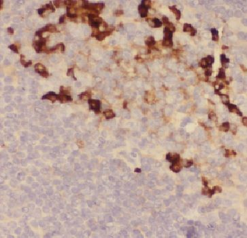 FAM78A Rabbit Polyclonal Antibody