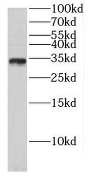 CIBAR1 Rabbit Polyclonal Antibody