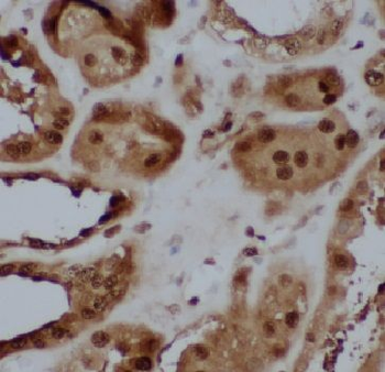 CIBAR1 Rabbit Polyclonal Antibody
