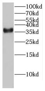 FAM98C Antibody