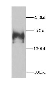 FANCA Rabbit Polyclonal Antibody
