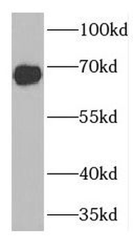 FANCG Antibody