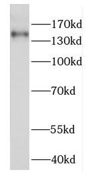 FANCI Rabbit Polyclonal Antibody