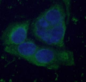 FBP1 Antibody