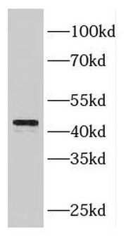 FBXL14 Antibody