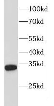 FBXL15 Antibody