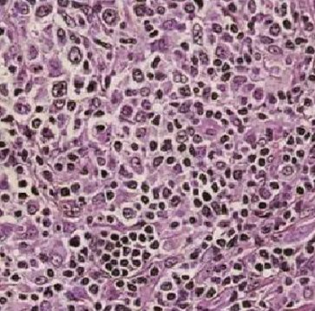 FBXL18 Antibody