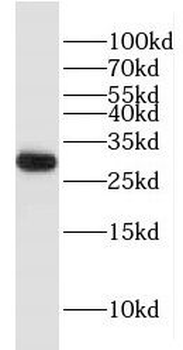 FBXO17 Rabbit Polyclonal Antibody