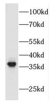 FBXO2 Antibody