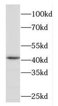 FBXO28 Rabbit Polyclonal Antibody